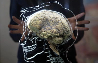 Американские ученые намерены оживить умерший мозг человека